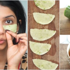 Receita Caseira para Olheiras – Como Fazer um Clareador de Olheiras